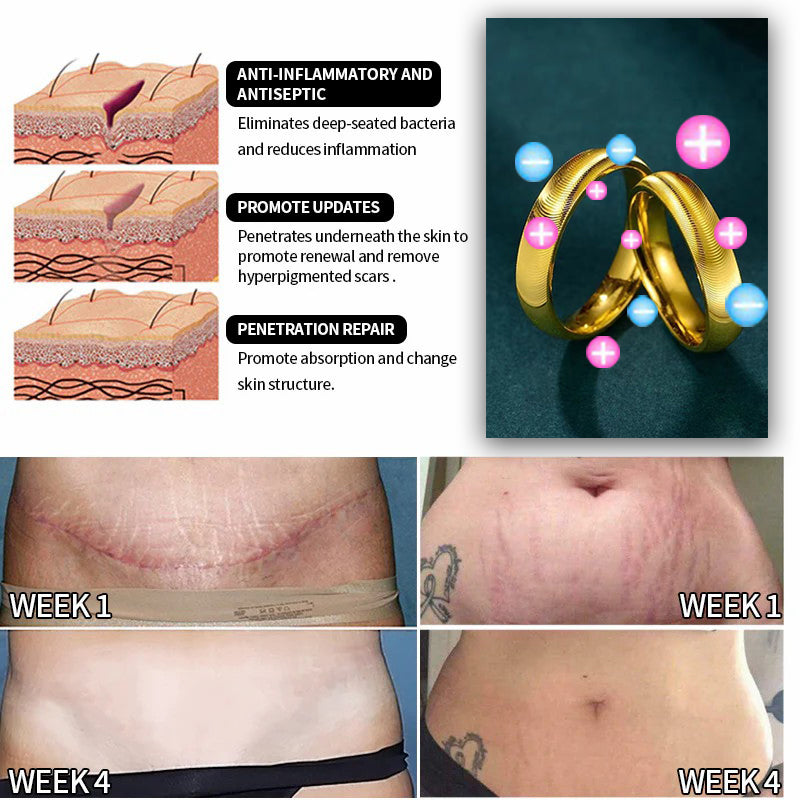 （🔥LAST DAY SALE-80% OFF) DIYSTAR💖Lymphatic magnetic therapy cats eye ring