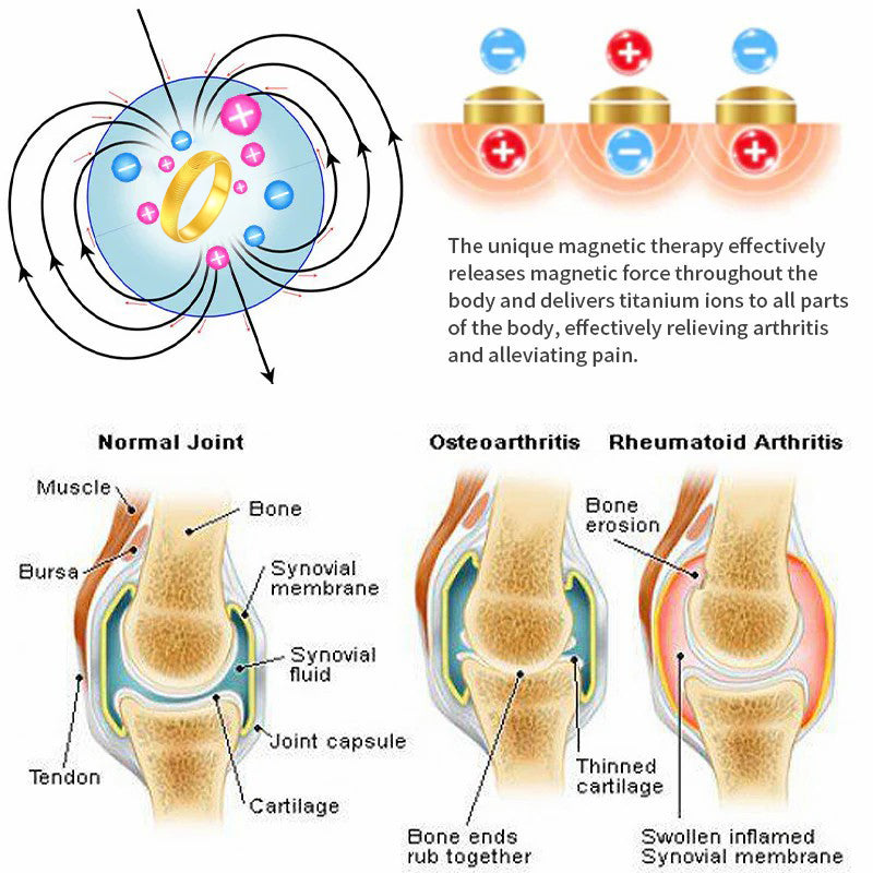 （🔥LAST DAY SALE-80% OFF) DIYSTAR💖Lymphatic magnetic therapy cats eye ring